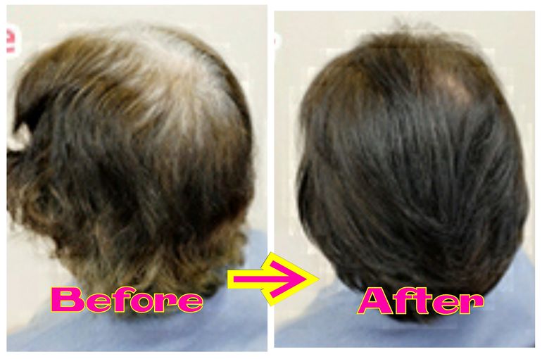 改めて 香草カラー の特徴とご紹介 名古屋で人気のヘアサロンはブログで新着情報をお届けしております